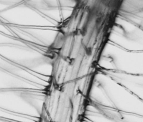 Root hairs