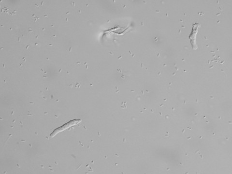 Verm1