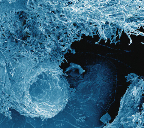 Pine tree root surrounded by a soil fungus