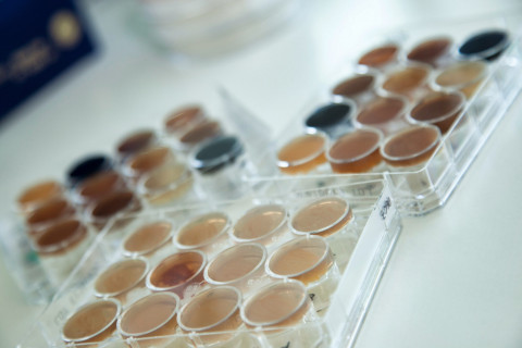 bacterial culture on plates