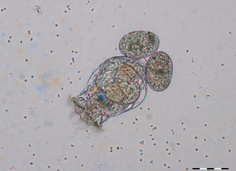 Raderdiertje Brachionus calyciflorus