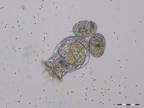 Raderdiertje Brachionus calyciflorus