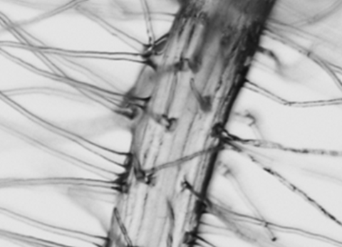 Root hairs
