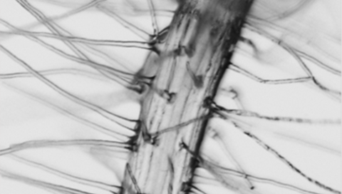Root hairs