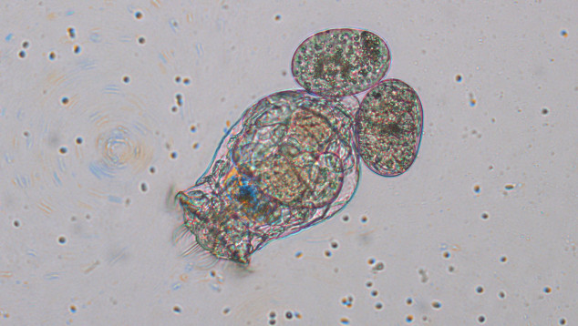 Raderdiertje Brachionus calyciflorus