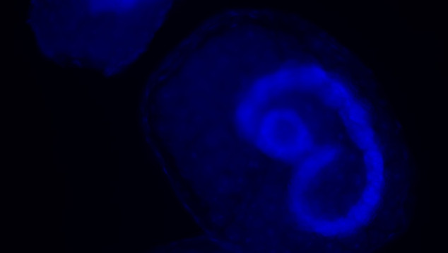 Embryo's van de kleine wintervlinder