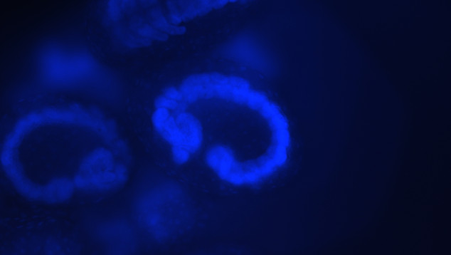 Fluorescence microscopy image of insect eggs