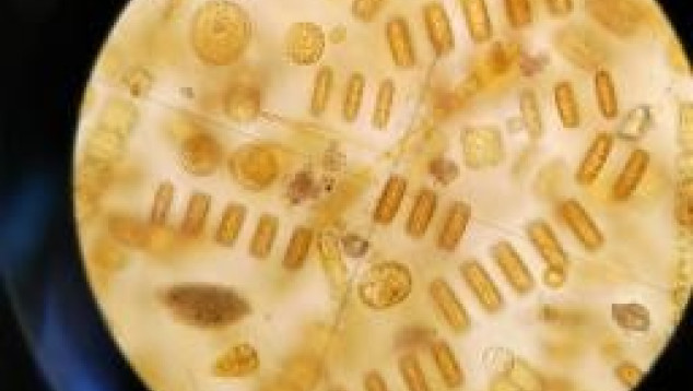 Plantaardig plankton onder de microscoop