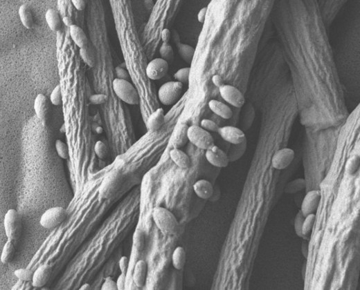 Yeast ecology and genomics