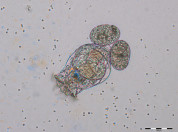 Raderdiertje Brachionus calyciflorus